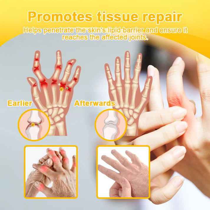 LOVILDS™ Botulinum Toxin & Bee Toxin Pain-Relief Bone Healing Cream❤️