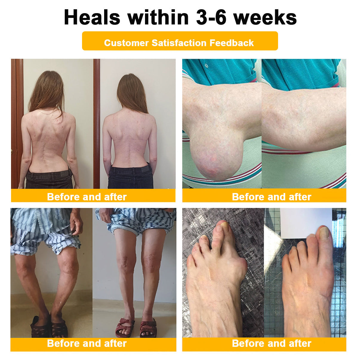 LOVILDS™ Botulinum Toxin & Bee Toxin Pain-Relief Bone Healing Cream❤️