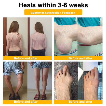 LOVILDS™ Botulinum Toxin & Bee Toxin Pain-Relief Bone Healing Cream❤️