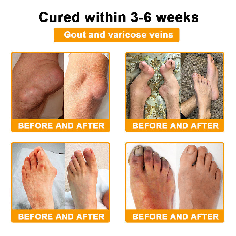 LOVILDS™ Botulinum Toxin & Bee Toxin Pain-Relief Bone Healing Cream❤️