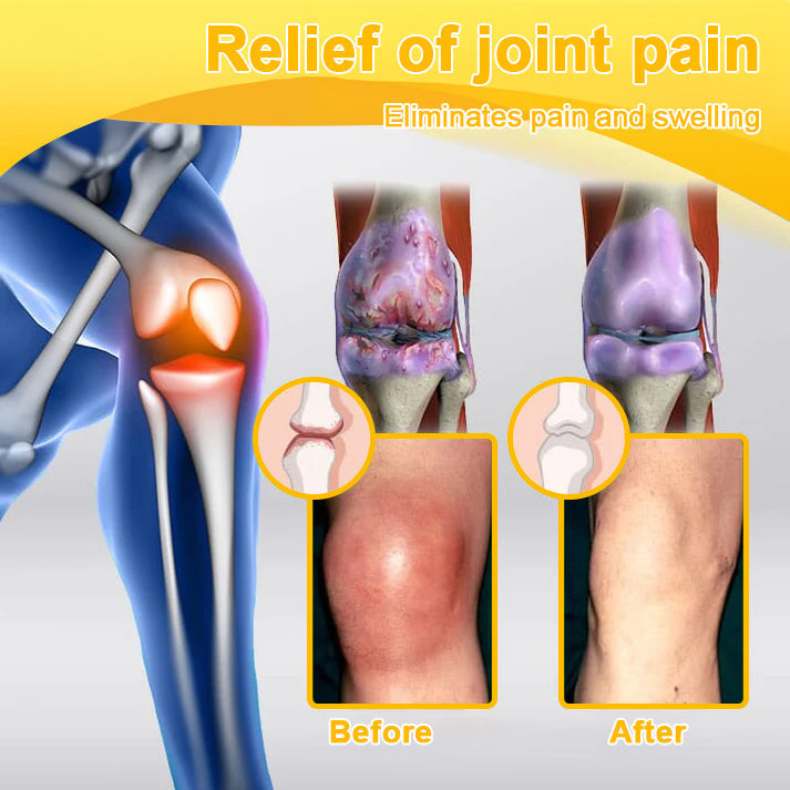 LOVILDS™ Botulinum Toxin & Bee Toxin Pain-Relief Bone Healing Cream❤️